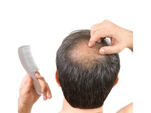 PNAS：用克隆技术培育头发 有望根治脱发谢顶