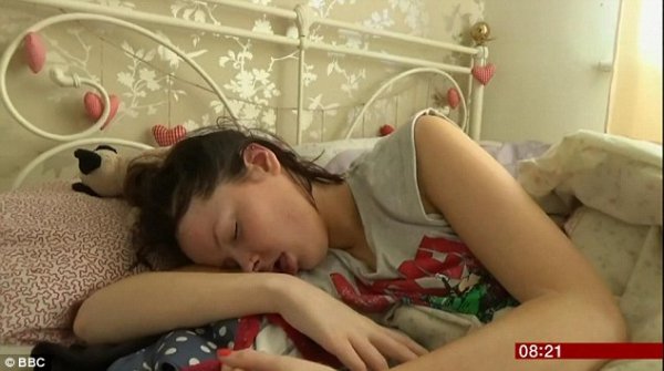 患“睡美人病”的女孩，发病时一天要睡22个小时