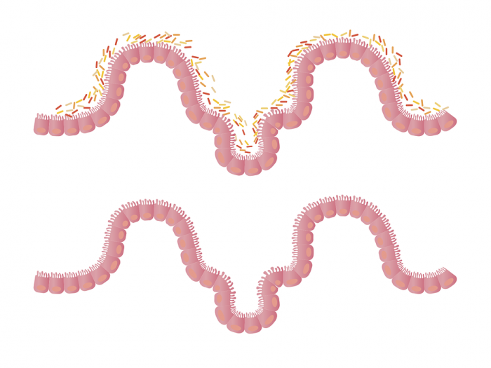 intestines-1468807_960_720.png