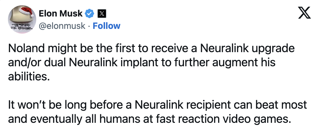 马斯克脑机接口意念控制机械臂!演示者获得钢铁之吻,理论上可控制一切
